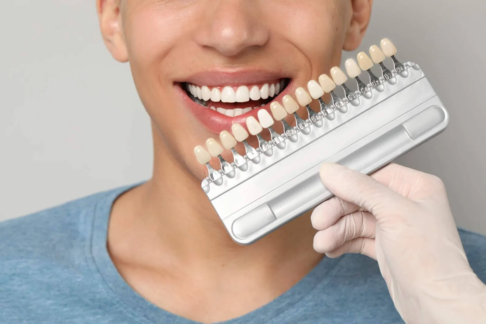 Instituto Smile Design by Fernando Soria combina urgencias dentales e Immediate Smile durante todo el verano